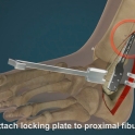 medical_motion_graphics